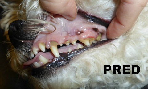 Zubný kameň - ochorenia dutiny ústnej
