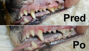 Zubný kameň - ochorenia dutiny ústnej